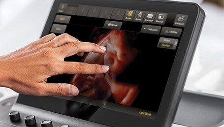 Samenwerking Philips en LeQuest uitgebreid